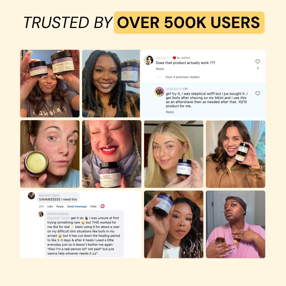 MyMagicHealer Universal Flare Care: A Game-Changer for Skin Flare-Ups