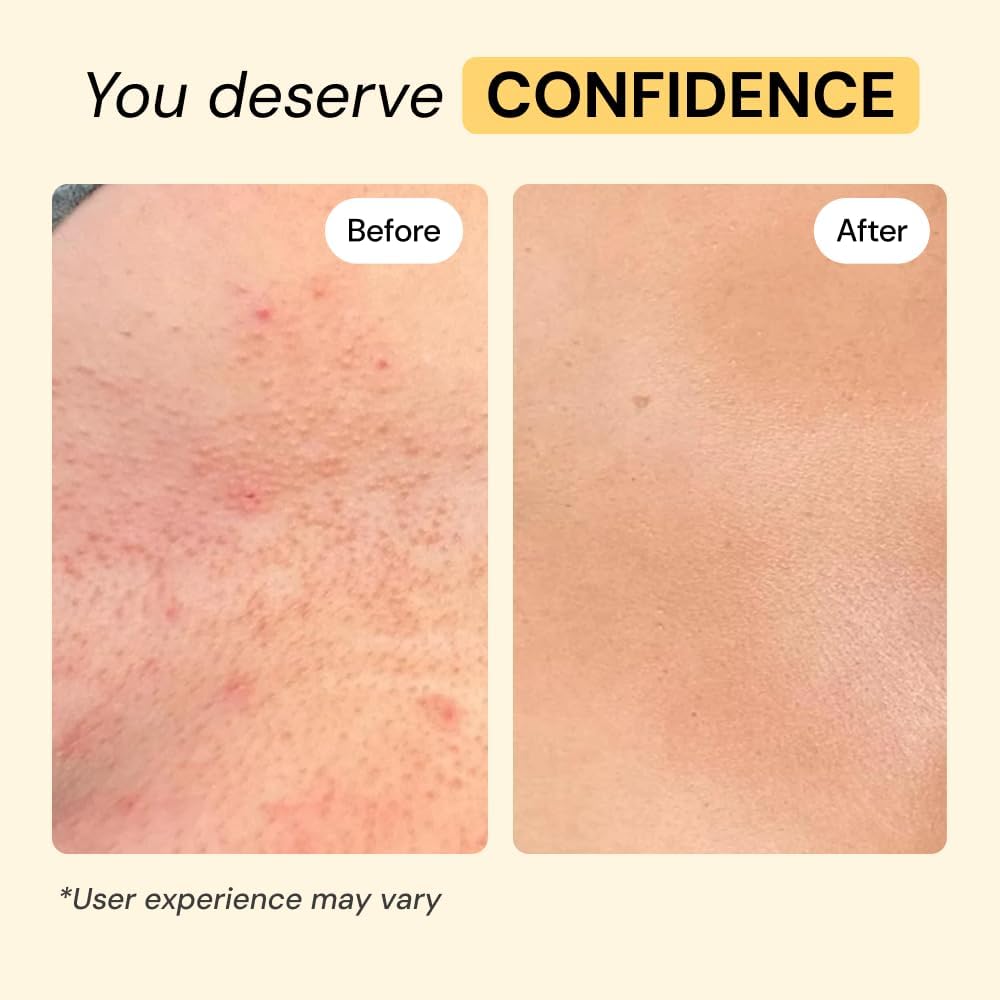 MyMagicHealer Universal Flare Care: A Game-Changer for Skin Flare-Ups