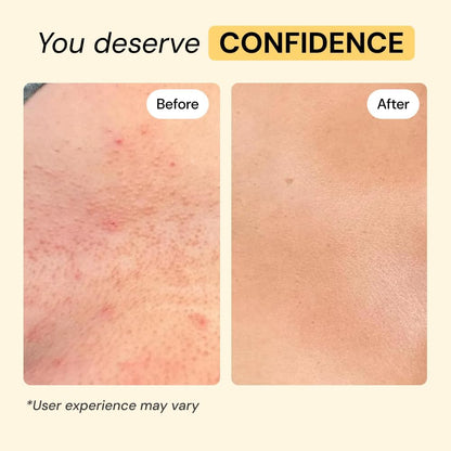 MyMagicHealer Universal Flare Care: A Game-Changer for Skin Flare-Ups