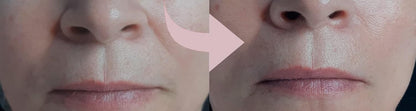 Casmara, Infinity Face Cream 50ml - Immediate Lifting Effect, Rejuvenates Mature Skin and Combats Deep Wrinkles