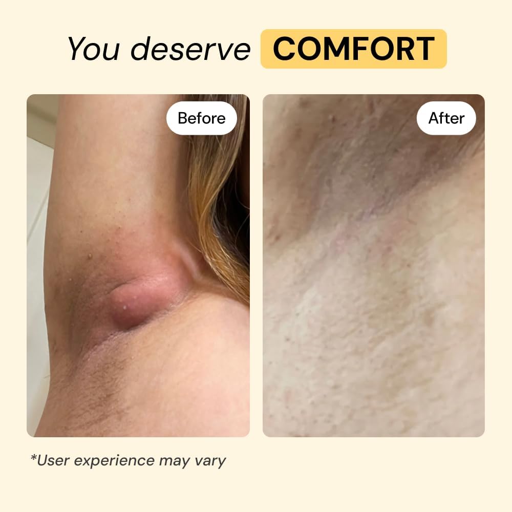 MyMagicHealer Universal Flare Care: A Game-Changer for Skin Flare-Ups