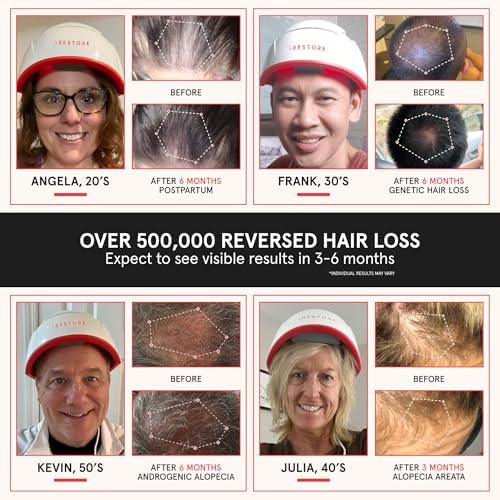 iRestore Root Revival Duo: Hair Growth Supplement and Laser Red Light Therapy for Hair Growth Device