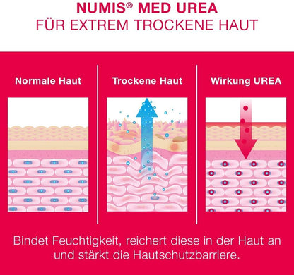 numis med Body Lotion with 5% Urea – Skin Soothing Body Lotion for Extremely Dry, Itch-prone Skin – Vegan Skin Care without Silicone, Parabens & Mineral Oil – Lotion (1 x 300 ml)
