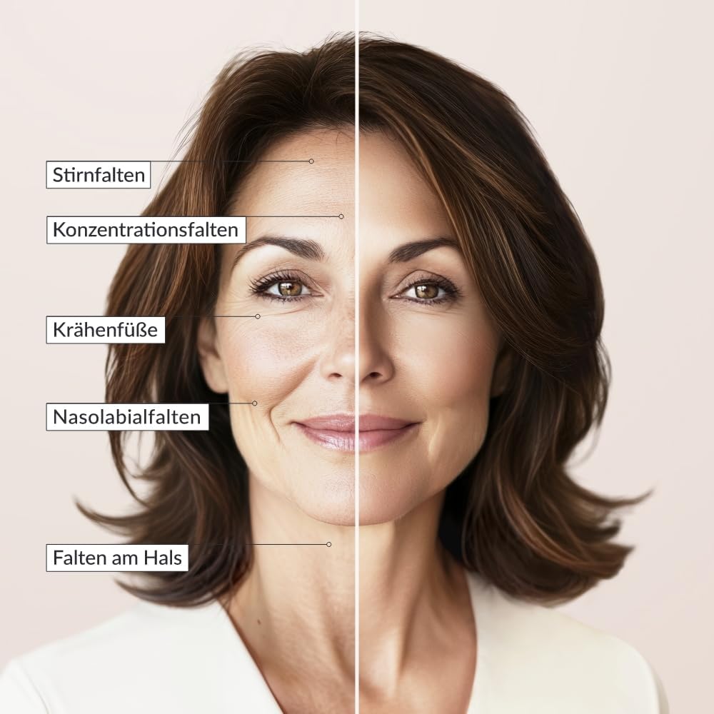 Medical Beauty® Global Anti-Ageing Day Cream Helps to Smooth Pronounced Wrinkles Immediate Effect with Lifting Effect Intensive Nourishing with Hyaluronic Acid for Mature Skin