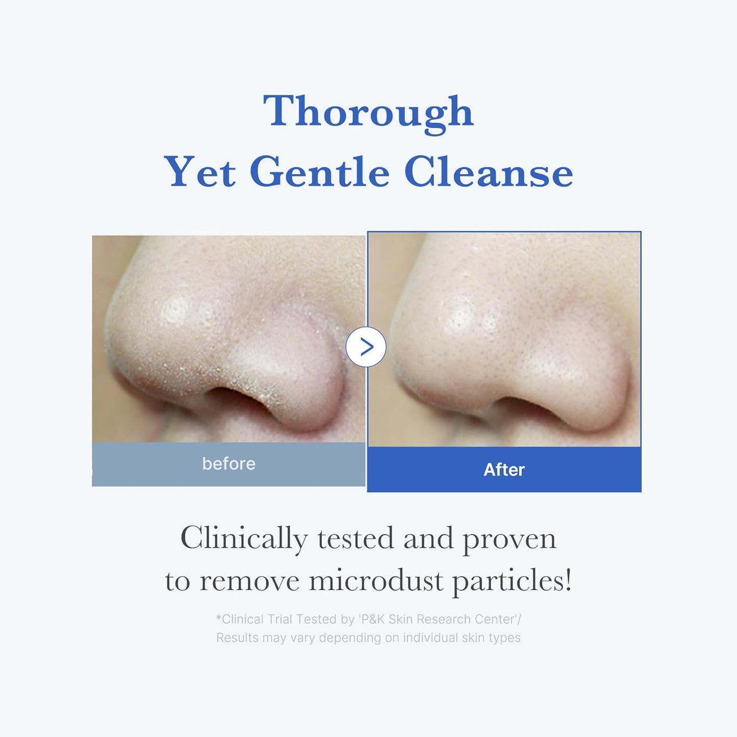 Medicube Zero Foam Cleanser: A Gentle Game-Changer for Sensitive Skin