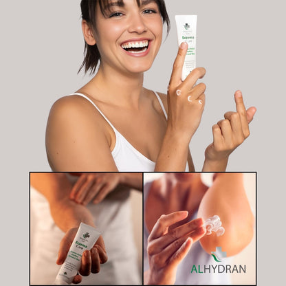 Eczema Care Cream with Pure Aloe Vera Gel | Prevents Eczema Flare-ups | Hypoallergenic & Clinically Proven | 59ml