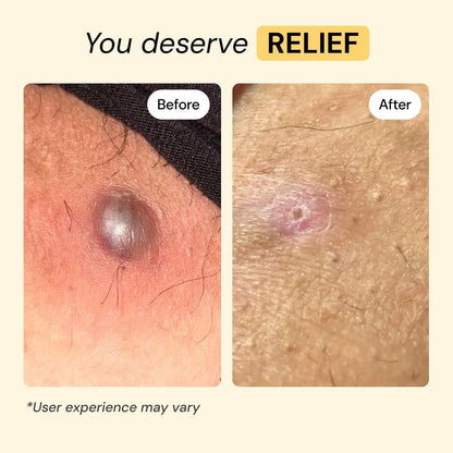 MyMagicHealer Universal Flare Care: A Game-Changer for Skin Flare-Ups