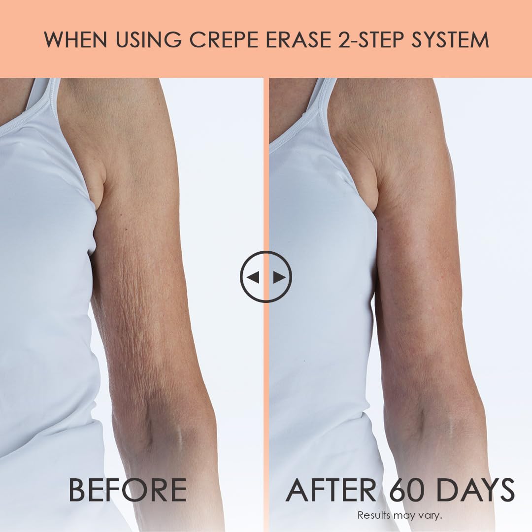 BODY FIRM Crepe Erase 2-Step Treatment, Anti-Aging Skin Care, Firming Moisturizer Cream + Body Exfoliating Pre-Treatment, Supports Wrinkle, Crepe Skin, Collagen