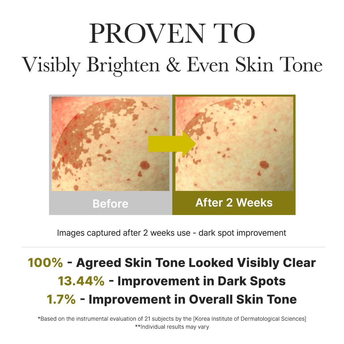 Arencia Vitamin C Booster Shot Serum with Glutathione, Niacinamide and Vitamin E for Dark Spot Care, Fine Lines & Wrinkles, Glass Skin, Korean Skincare 30ml/1.01 fl.oz