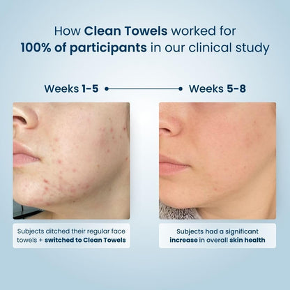 Clean Skin Club Clean Towels XL®, 100% USDA Biobased Gesichts-Handtuch, Einweg-Gesichts-Tuch, von der Eczema Association akzeptiert, Make-up-Entferner Trockentücher, ultraweich, 1 Packung, 50 Stück