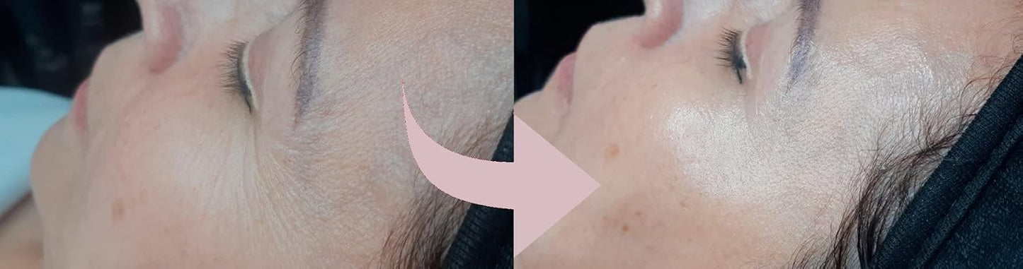 Casmara, Infinity Face Cream 50ml - Immediate Lifting Effect, Rejuvenates Mature Skin and Combats Deep Wrinkles