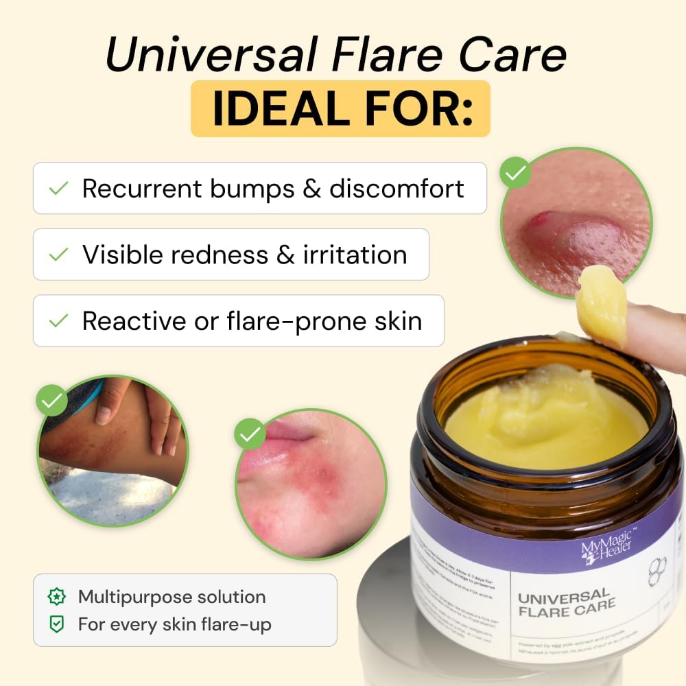 MyMagicHealer Universal Flare Care: A Game-Changer for Skin Flare-Ups