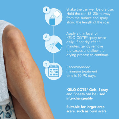 KELO-COTE Scar Spray 100ml – Silicone Scar Treatment - Clinically Proven to Reduce Raised Scars - Ideal for Surgical, Burn, and Keloid Scars - Old & New Scars