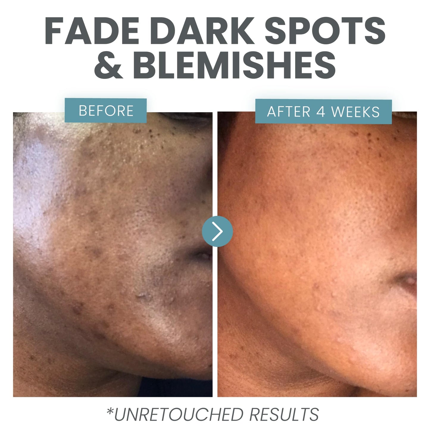 Eva Naturals Vitamin C Serum für das Gesicht – Anti-Aging Dark Spot Remover mit Retinol, Hyaluronsäure, Niacinamid & Salicylsäure – Gesichtsserum für Frauen für klare, glatte, strahlende Haut