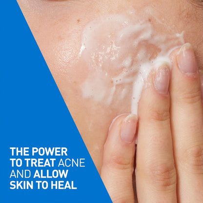 CeraVe 4% Benzoylperoxid Aknebehandlung Schäumendes Reinigungsgel für Gesicht & Körper, mit Hyaluronsäure und Niacinamid. Hilft, Akne-Pickel zu klären und Ausbrüchen vorzubeugen. Sanftes Gel, Parfümfrei, 150ml