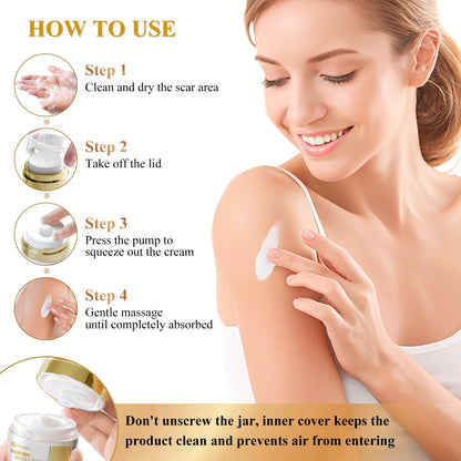 Scar Cream Silicone Scar Gel, Scar Cream for Surgical Scars, Advanced Scar Removal Cream for C-Section, Injury, Acne, Burns, Keloids, Stretch Marks, Old & New Scars, 1.85 Oz (55g)