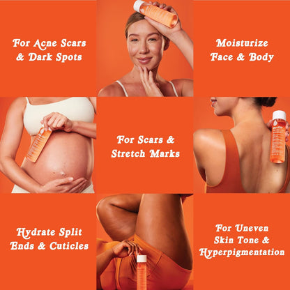 Bio-Oil Skincare Body Oil Serum: A Game-Changer for Scars, Stretch Marks, and Sensitive Skin