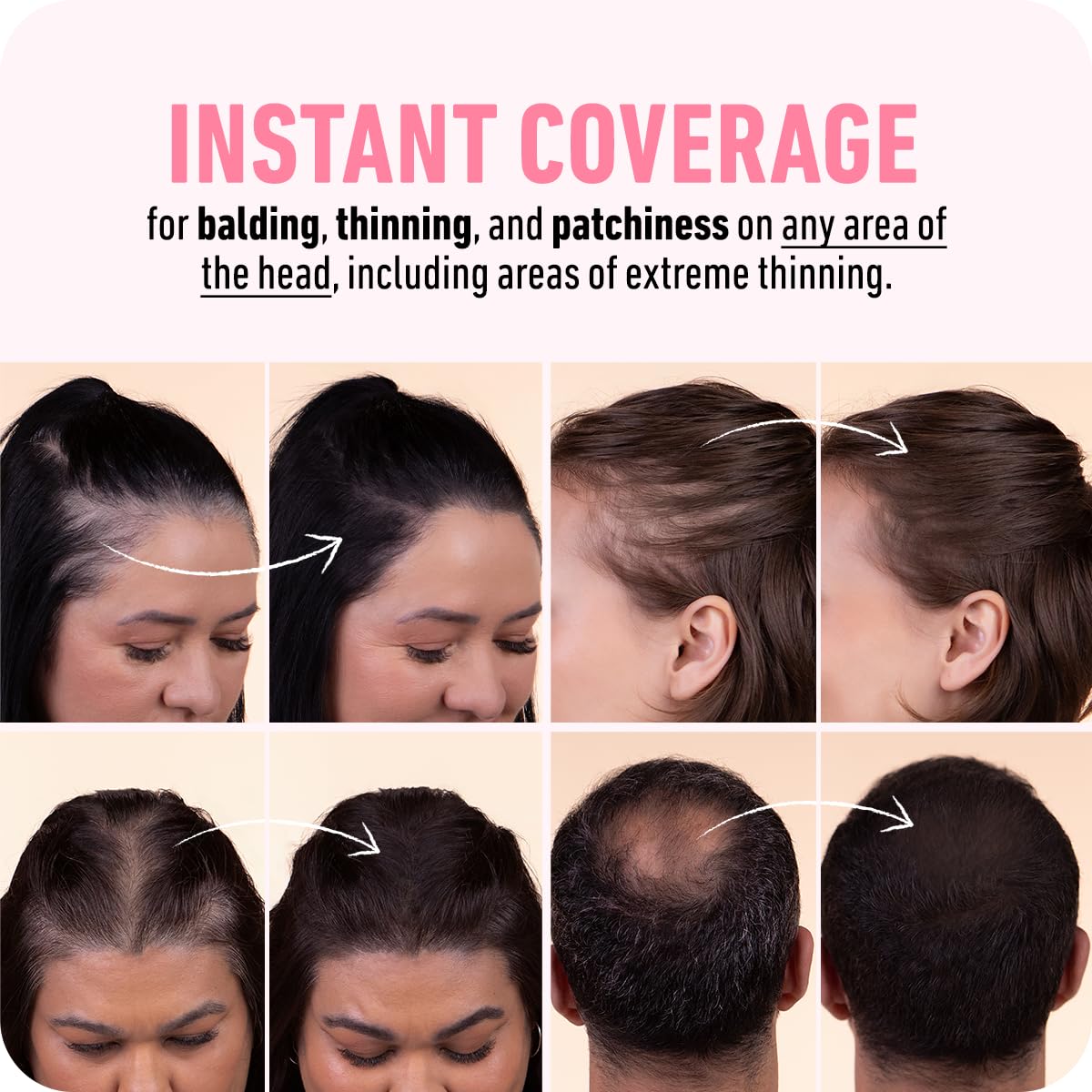 BOLDIFY Hairline Powder: A Game-Changer for Gray Coverage and Thinning Hair