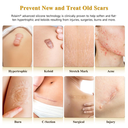 Scar Cream Silicone Scar Gel, Scar Cream for Surgical Scars, Advanced Scar Removal Cream for C-Section, Injury, Acne, Burns, Keloids, Stretch Marks, Old & New Scars, 1.85 Oz (55g)