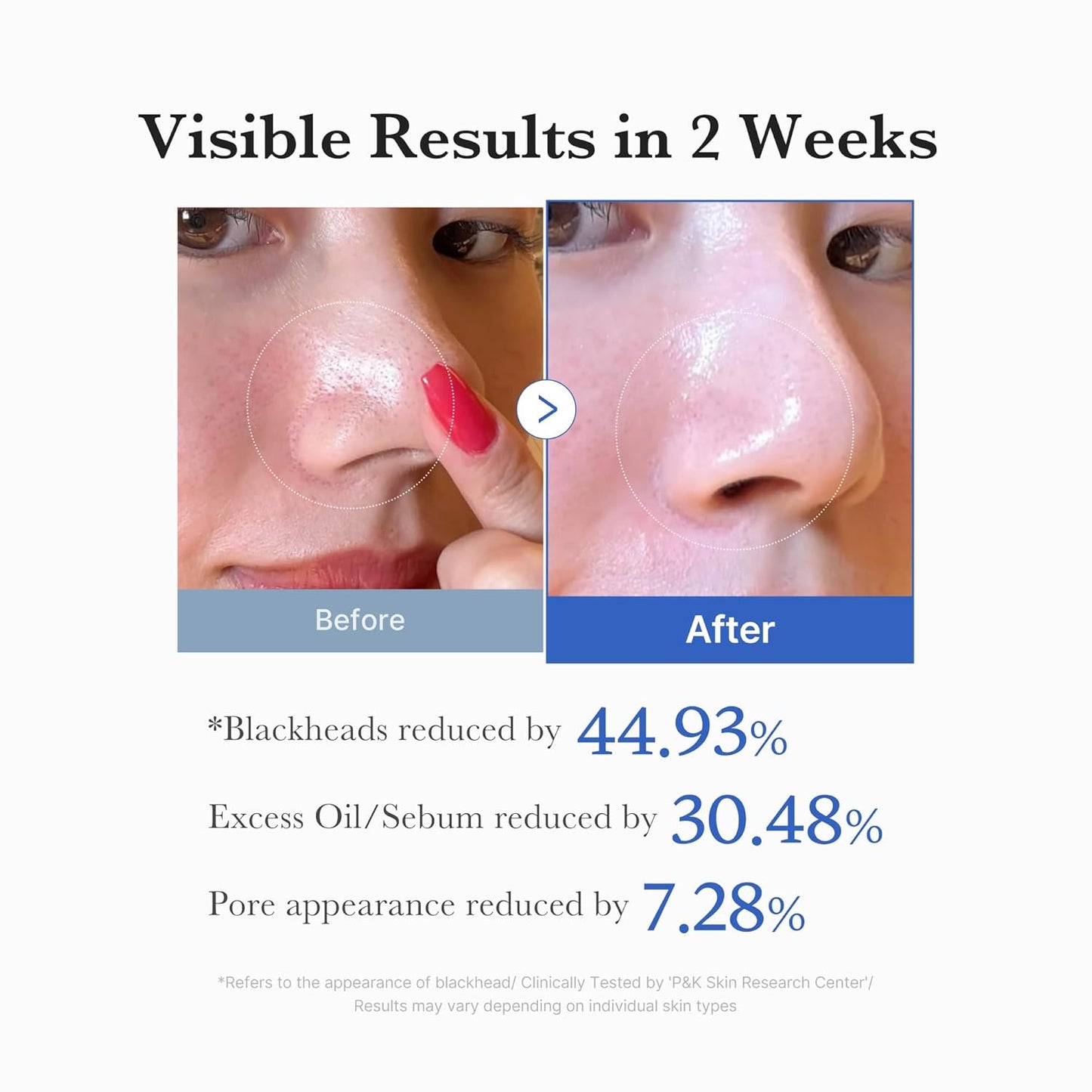 medicube Toner Pads Zero Pore Pad 2.0: A Game-Changer for Pore Care and Exfoliation