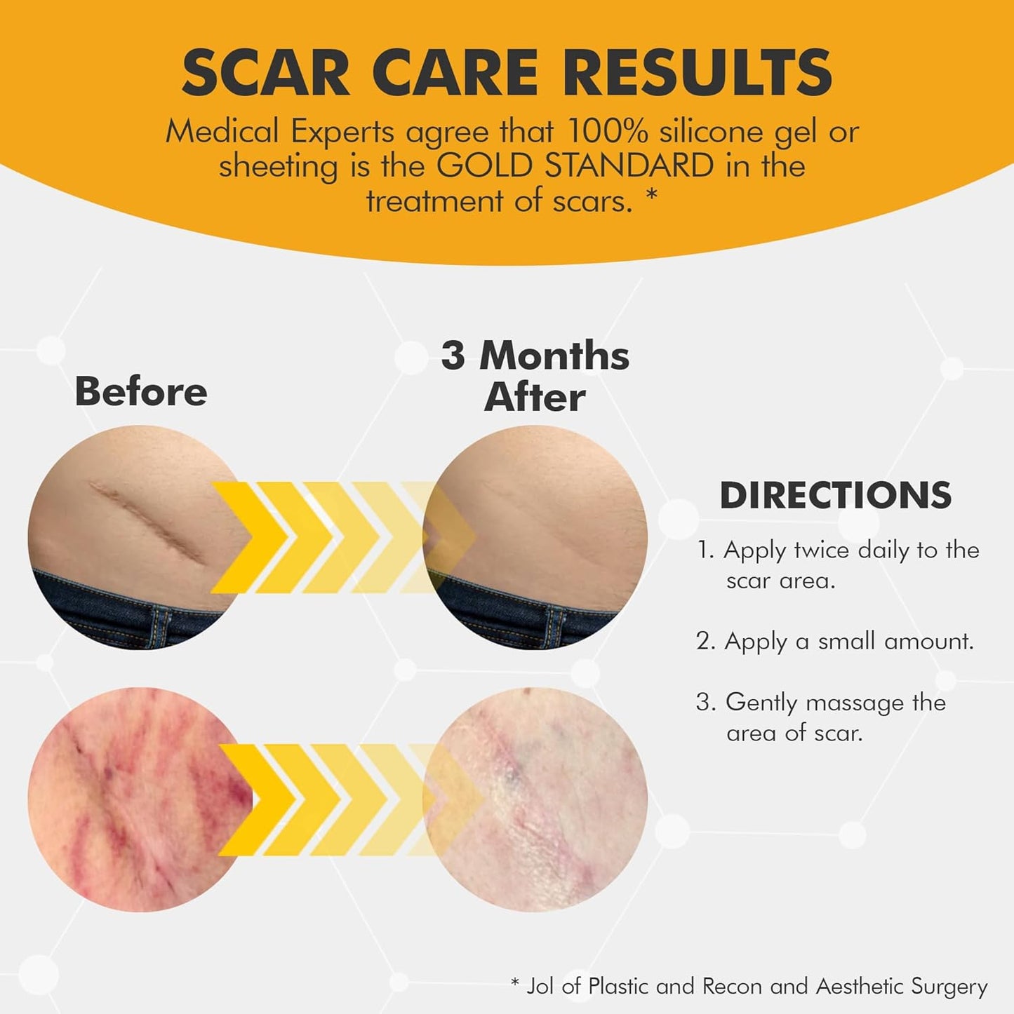 DermAvance Pure Scar Care "Medical Grade Silicone Gel" for Surgical and Facial Marks - Silicone Cream for Effective Scar Management - 1.05822 fl oz (30g), Clear