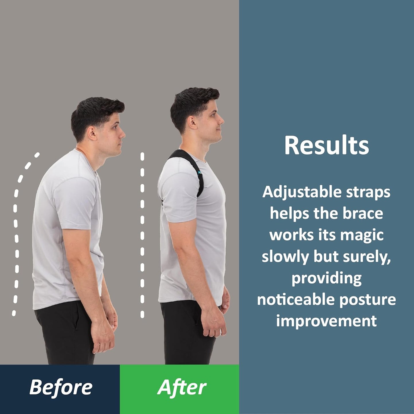 Straighten Up: Say Goodbye to Back Pain with ComfyBrace Posture Corrector