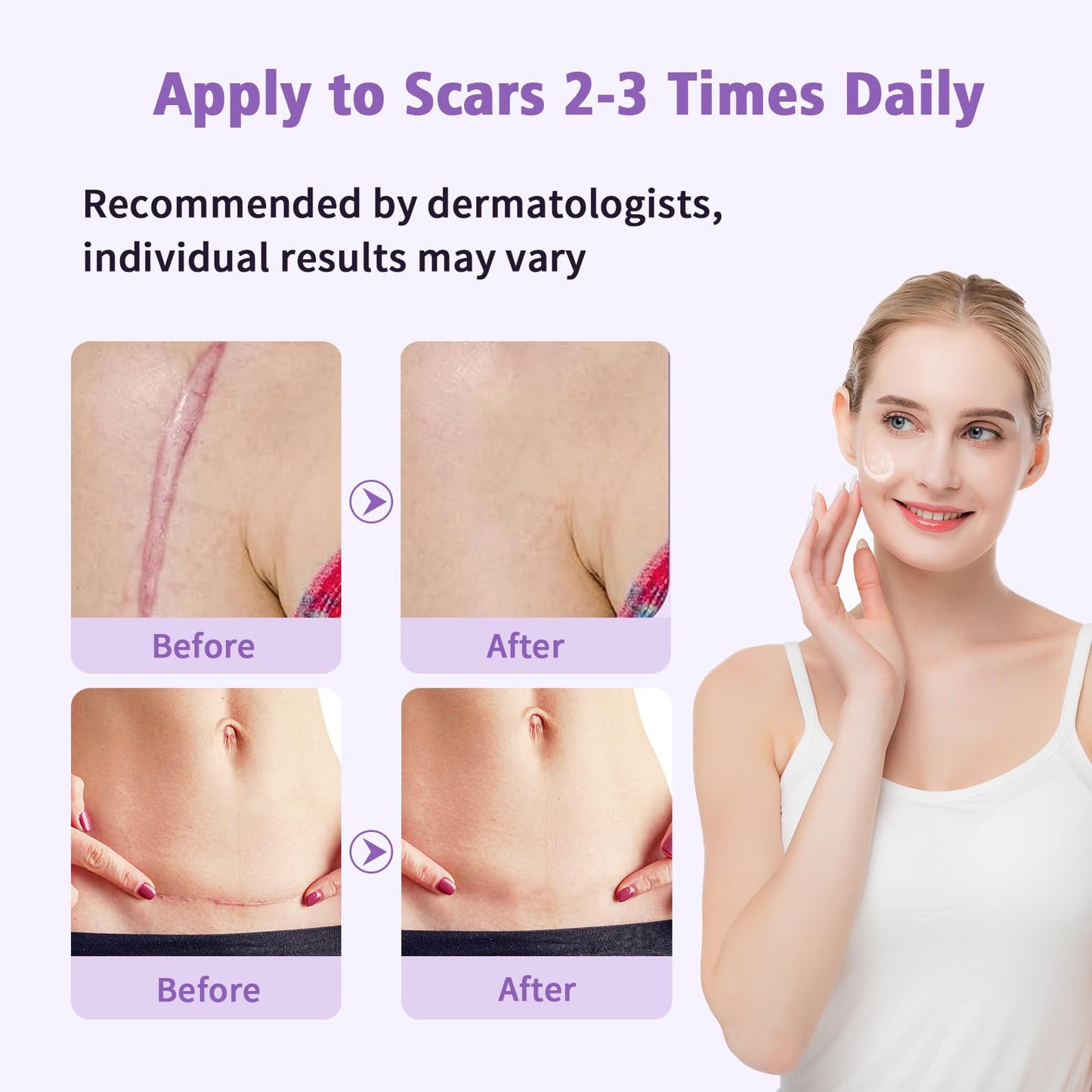 Medical Grade Silicone Scar Gel - Advanced Scar Removal Cream & Scar Treatment for Surgical, C-Section, Hypertrophic & Acne Scars - 1.7oz