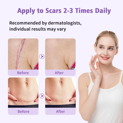 Medical Grade Silicone Scar Gel - Advanced Scar Removal Cream & Scar Treatment for Surgical, C-Section, Hypertrophic & Acne Scars - 1.7oz