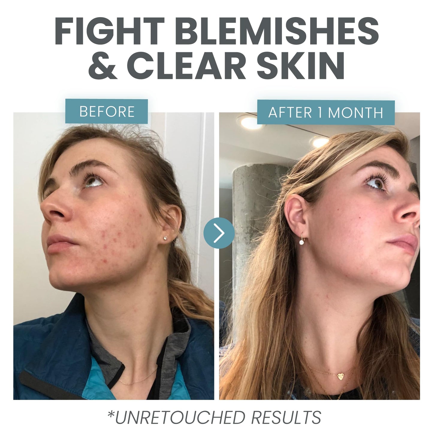 Eva Naturals Vitamin C Serum für das Gesicht – Anti-Aging Dark Spot Remover mit Retinol, Hyaluronsäure, Niacinamid & Salicylsäure – Gesichtsserum für Frauen für klare, glatte, strahlende Haut