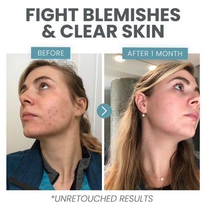 Eva Naturals Vitamin C Serum für das Gesicht – Anti-Aging Dark Spot Remover mit Retinol, Hyaluronsäure, Niacinamid & Salicylsäure – Gesichtsserum für Frauen für klare, glatte, strahlende Haut
