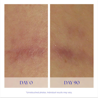 iS CLINICAL Super Serum Advance+, Anti-Aging Vitamin C Face Serum, reduces scaring and fine stretch marks