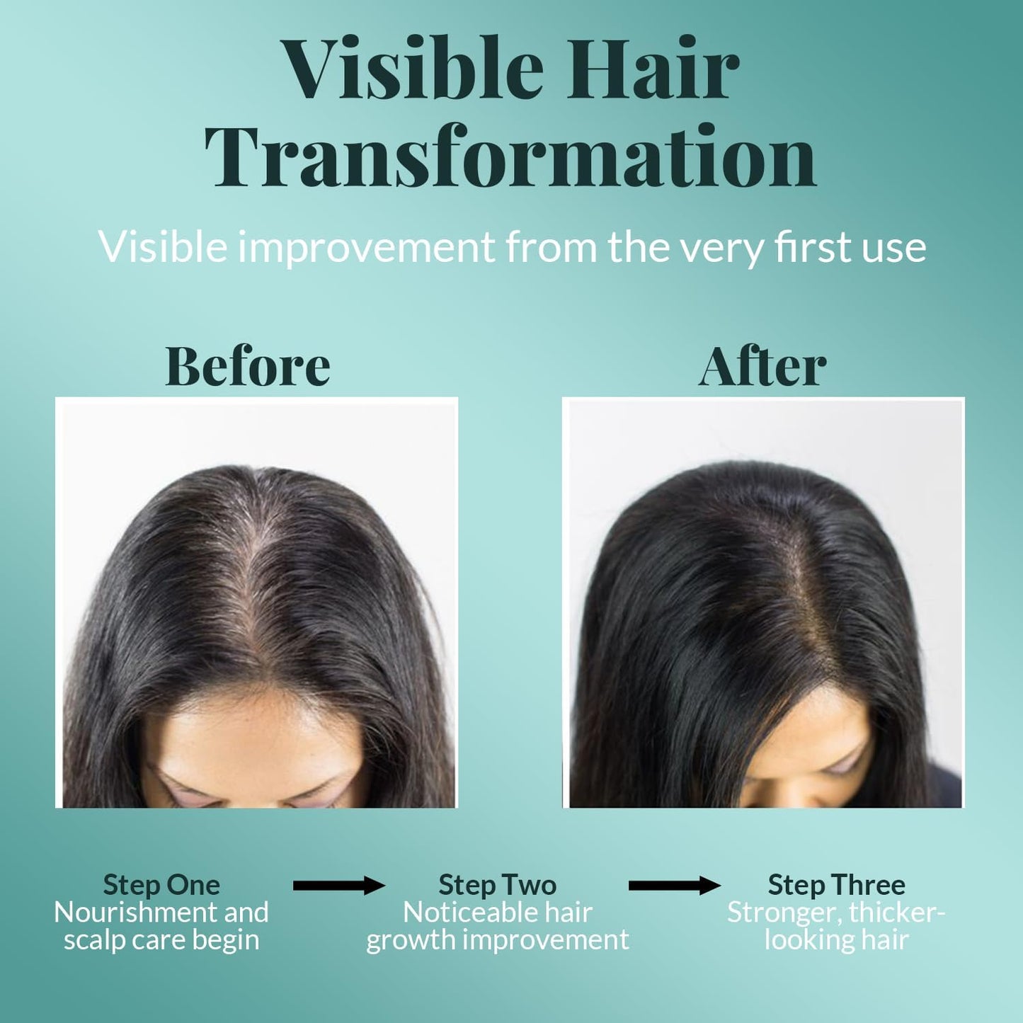 AVD Organics Rosmarinöl für Haarwachstum & Kopfhaut | Mit Biotin angereichert | Haarstärkend, pflegend und voluminös | Mit Jojoba- & Rizinusöl angereichert | GVO-frei 120ml