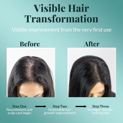 AVD Organics Rosmarinöl für Haarwachstum & Kopfhaut | Mit Biotin angereichert | Haarstärkend, pflegend und voluminös | Mit Jojoba- & Rizinusöl angereichert | GVO-frei 120ml