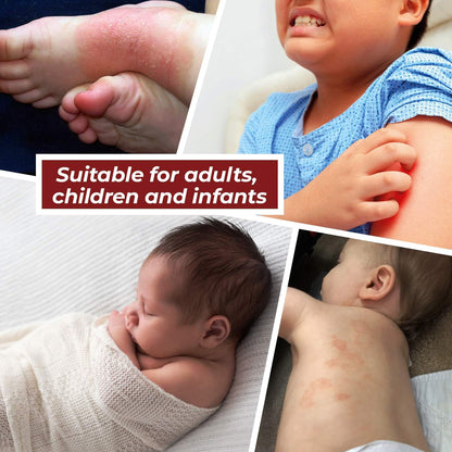 Psoriasis Cream Multipack (3 x 100ml). A Rich, Non-Greasy Skin Cream Specially Formulated to Help Alleviate The Symptoms of Psoriasis, Eczema & Related Dry Skin Conditions