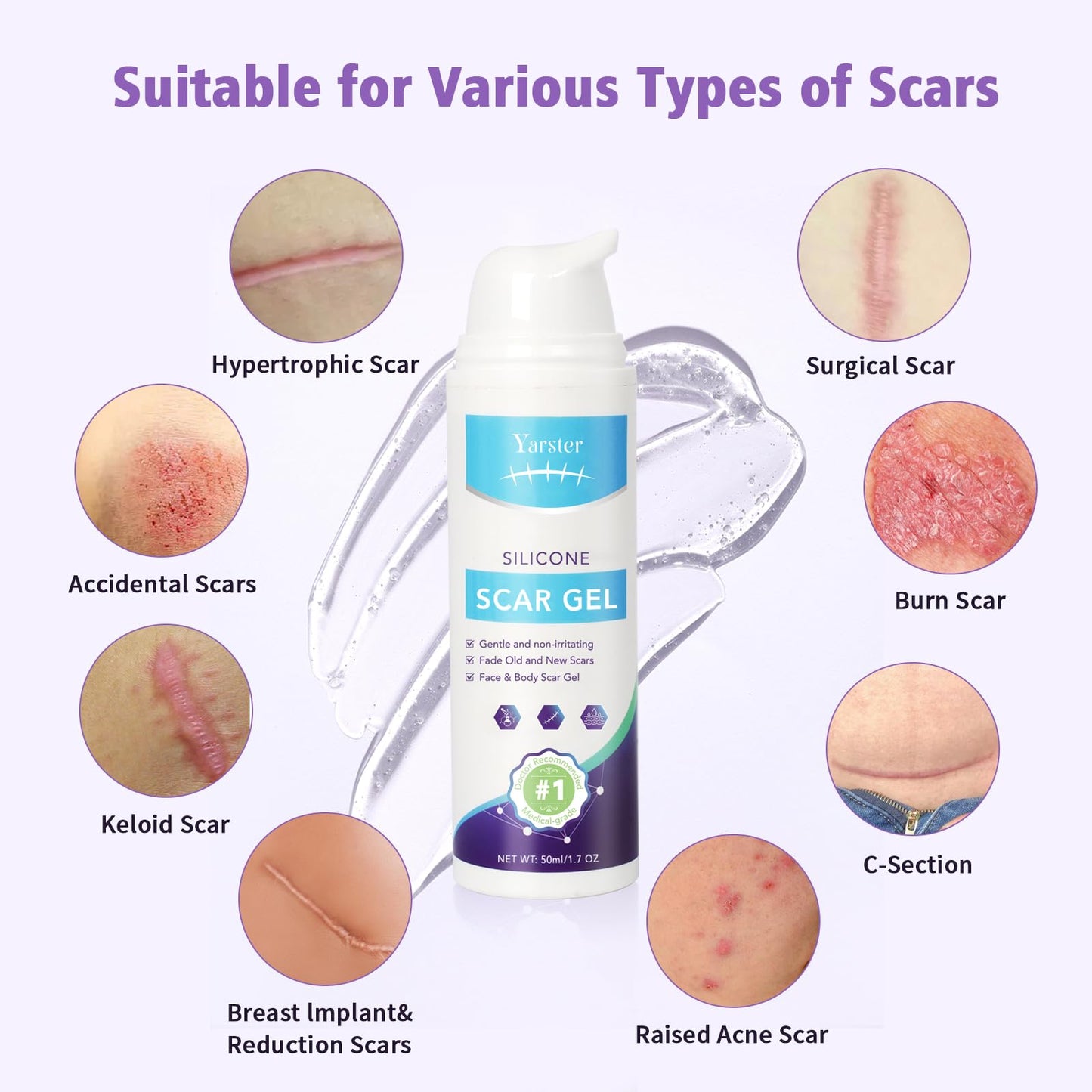 Medical Grade Silicone Scar Gel - Advanced Scar Removal Cream & Scar Treatment for Surgical, C-Section, Hypertrophic & Acne Scars - 1.7oz