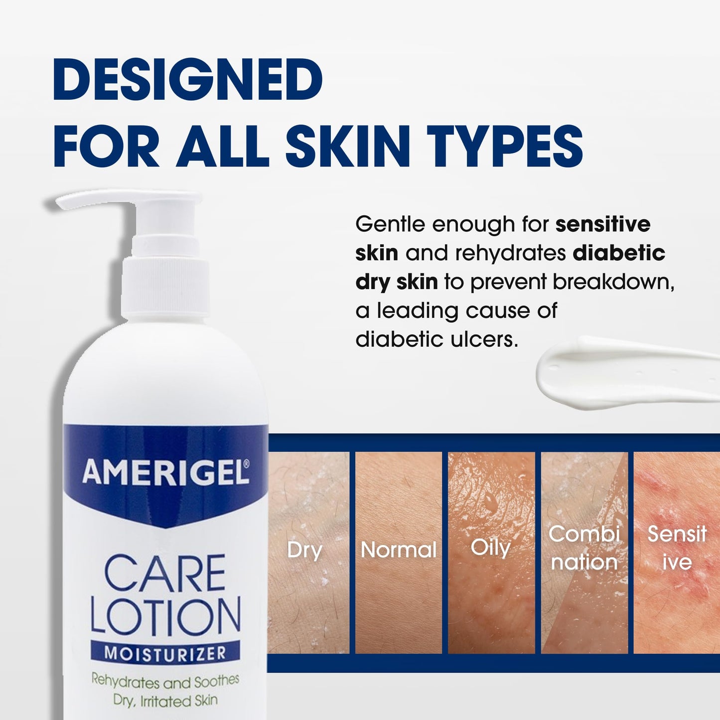 AMERIGEL Care Lotion – Hypoallergenic Moisturizer - Diabetic Skin Care - Rehydrates and Soothes Dry, Irritated Skin - 16 oz.