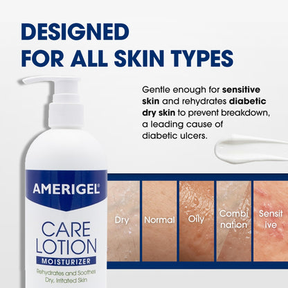 AMERIGEL Care Lotion – Hypoallergenic Moisturizer - Diabetic Skin Care - Rehydrates and Soothes Dry, Irritated Skin - 16 oz.