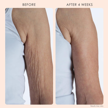 BODY FIRM Crepe Erase 2-Step Treatment, Anti-Aging Skin Care, Firming Moisturizer Cream + Body Exfoliating Pre-Treatment, Supports Wrinkle, Crepe Skin, Collagen