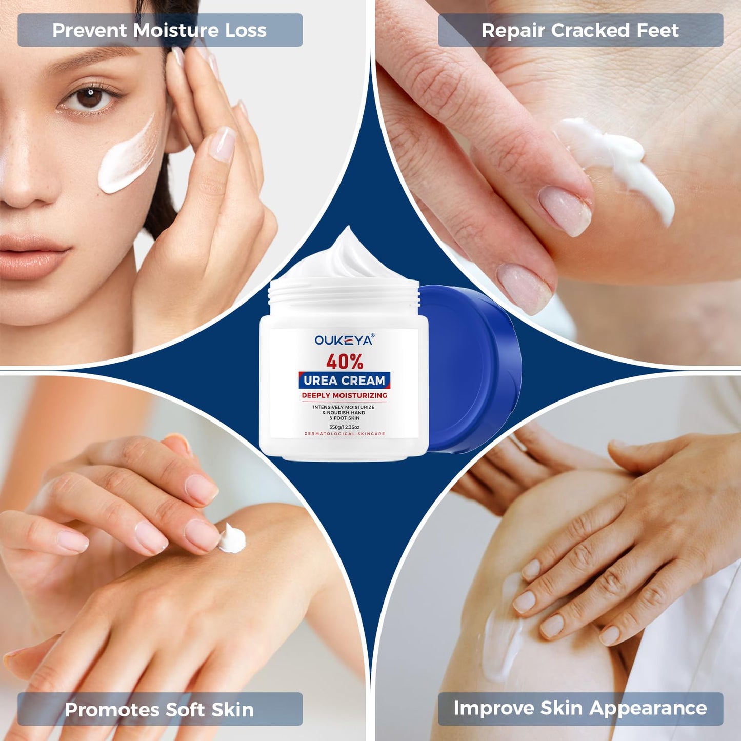 OUKEYA Urea Cream 40 Percent,Foot & Hand Cream for Dry Cracked,Urea Lotion for Feet Maximum Strength
