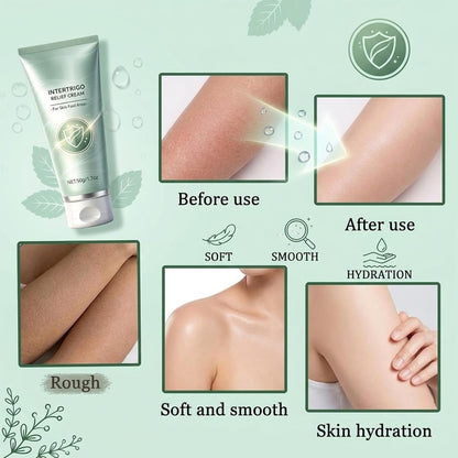3PCS Intertrigo Relief Cream, Skin Fold Care Cream for Under Breast, Groin & Thighs, Moisture Barrier Cream, Fast-Drying Non-Greasy Formula for Daily Skin Protection, 2 Oz Each