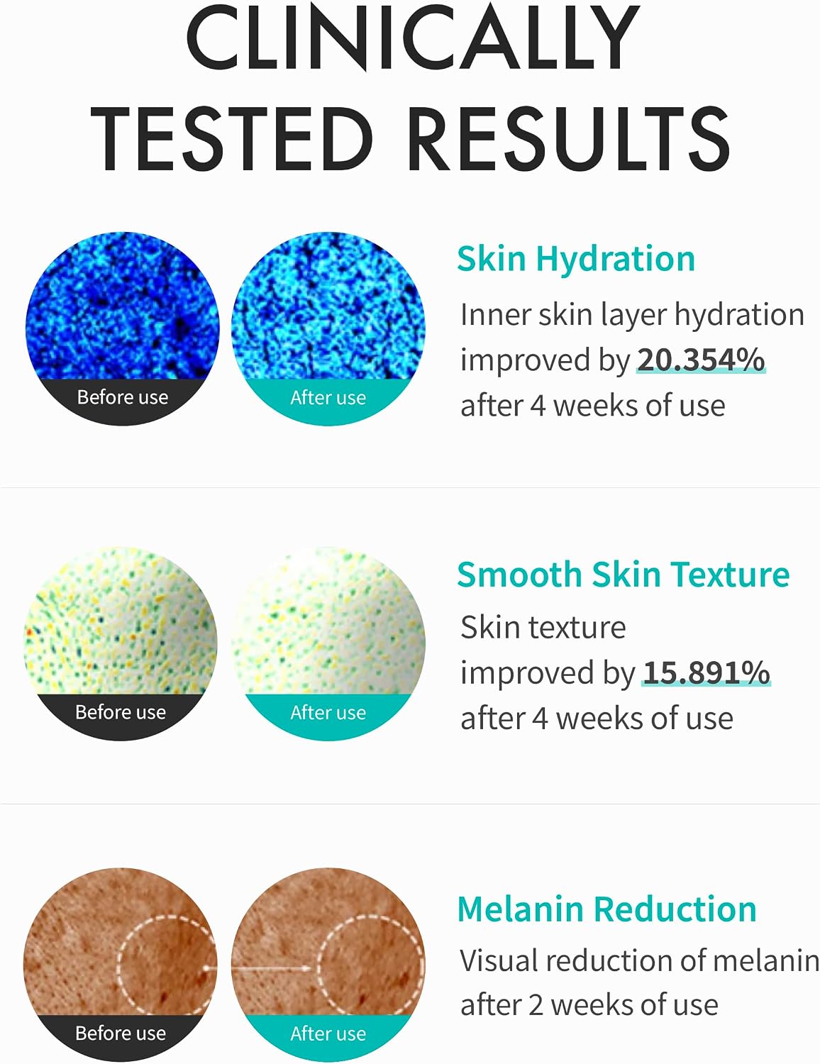 REJURAN Turnover Cream Enhanced, Dot Pdrn Salmon Dna Pdrn Face Moisturizer For Regeneration, 1.69 Fl Oz (Pack Of 1)