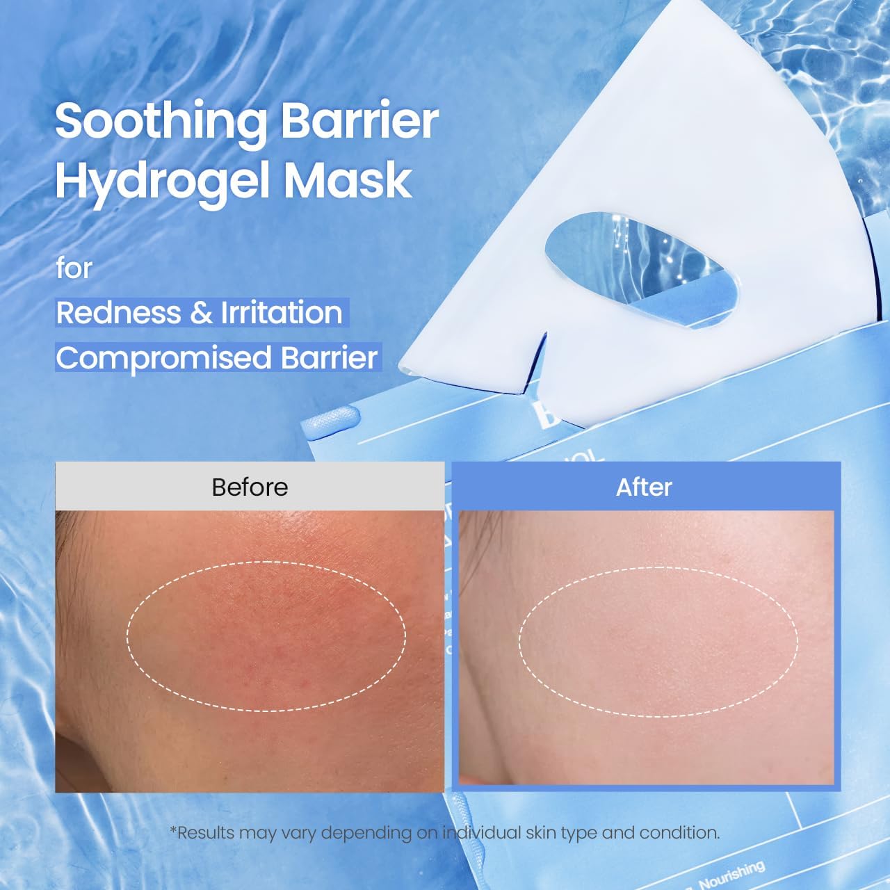 BIODANCE Hydro Cera-nol Real Deep Mask, Hydrogel Mask, Soothing, Moisturising, Nutritious, Korean Skin Care, 34 g x 4 PiecesBIODANCE Hydro Cera-nol Real Deep Mask, Hydrogel Mask, Soothing, Moisturising, Nutritious, Korean Skin Care, 34 g x 4ea