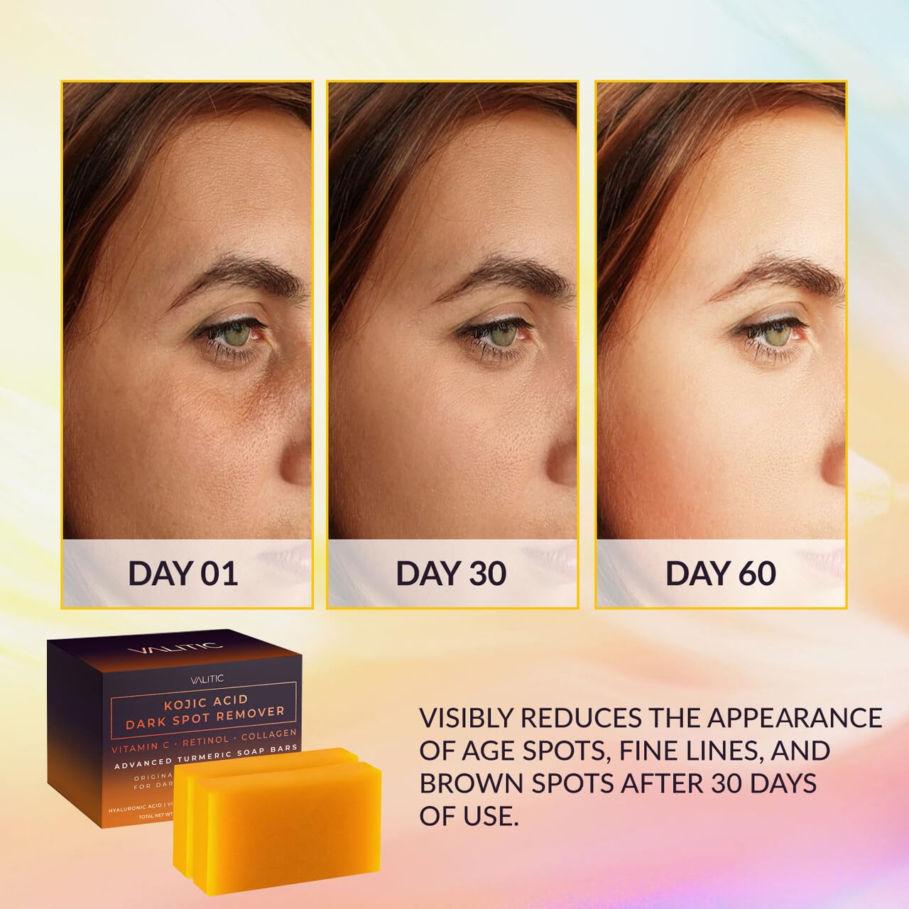 VALITIC Kojic Acid Dark Spot Remover Soap Bars