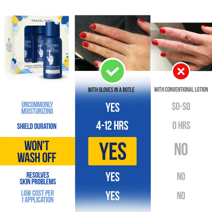 Gloves In A Bottle Shielding Lotion for Dry Itchy Skin, 2 ounce (Pack of 24)