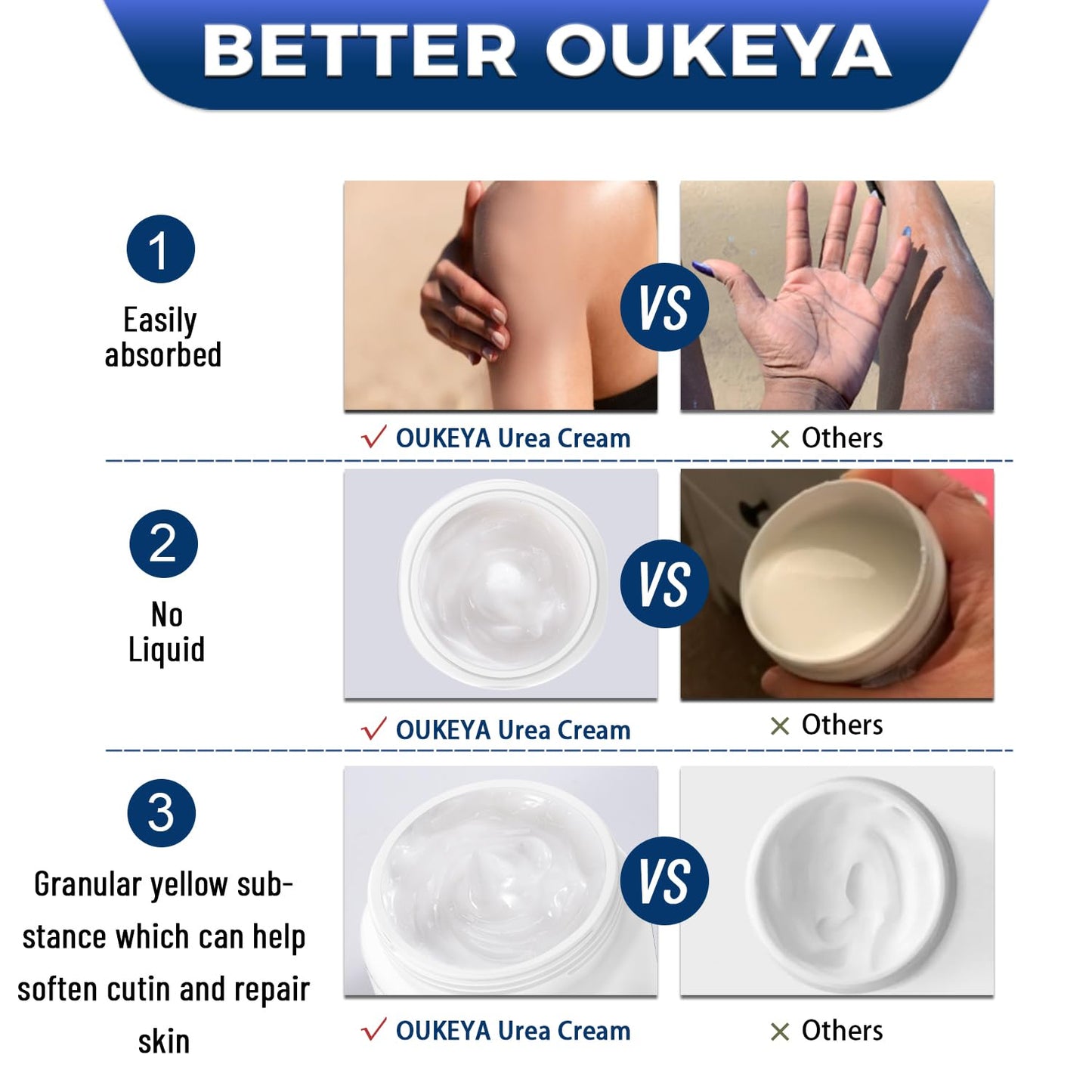 OUKEYA Urea Cream 40 Percent,Foot & Hand Cream for Dry Cracked,Urea Lotion for Feet Maximum Strength