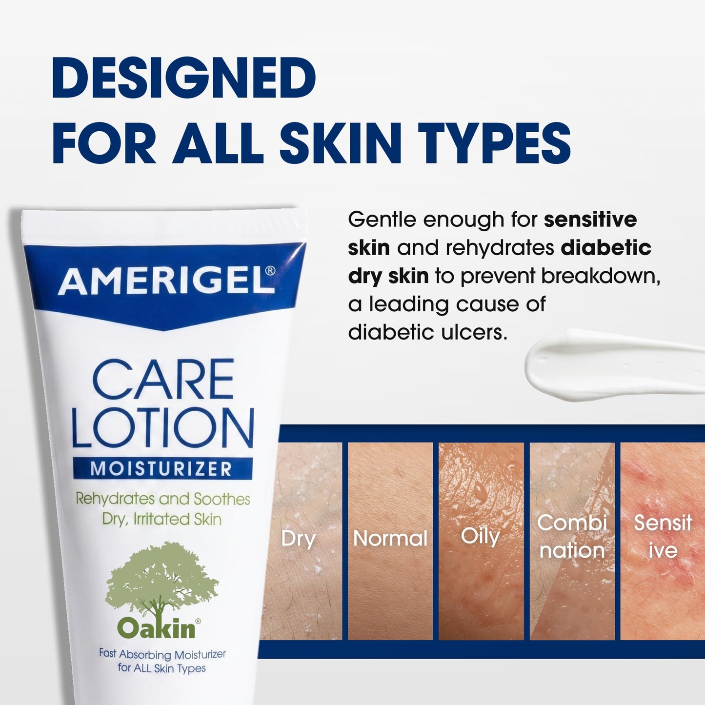 AMERIGEL Care Lotion – Hypoallergenic Moisturizer - Diabetic Skin Care - Rehydrates and Soothes Dry, Irritated Skin - 16 oz.