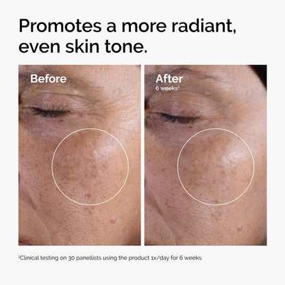 The Ordinary Glycolic Acid 7% Exfoliating Toner: A Game-Changer for Smoother Skin