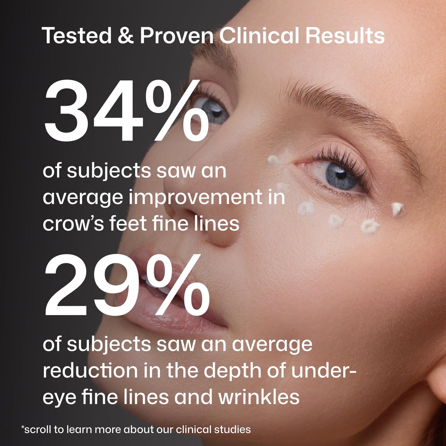 Revision Skincare D·E·J Eye Cream®, Firming and Moisturizing Treatment for Fine Lines, Wrinkles and Crow’s Feet