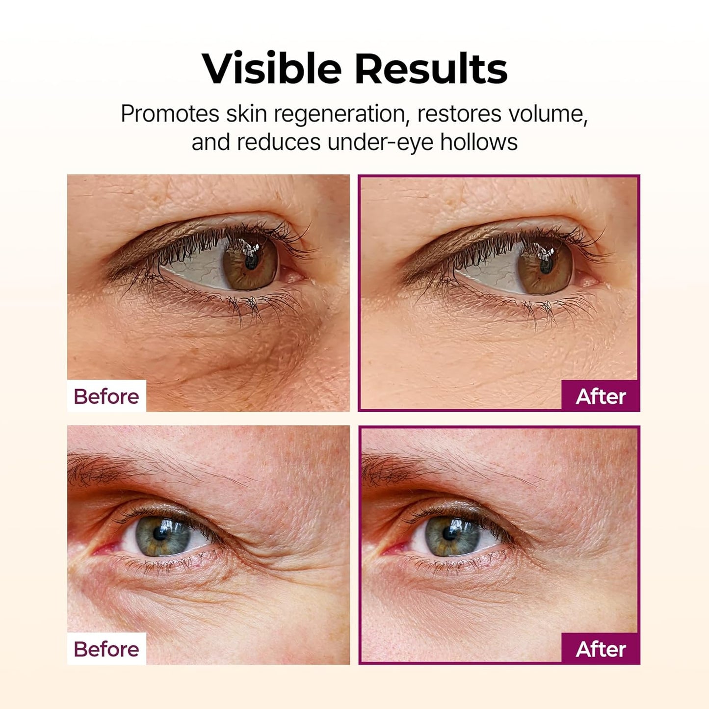 Dr.Melaxin Collagen Multi Balm Stick: A Game-Changer for Wrinkles and Dark Circles