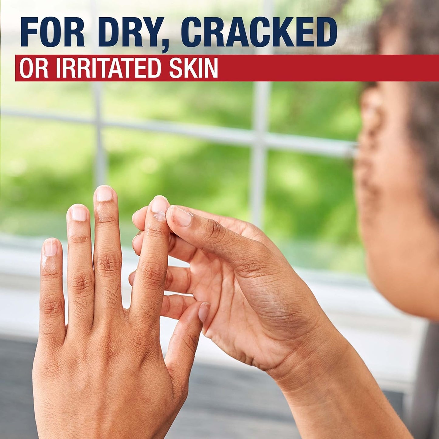 Aquaphor Healing Ointment: The Ultimate Skin Savior